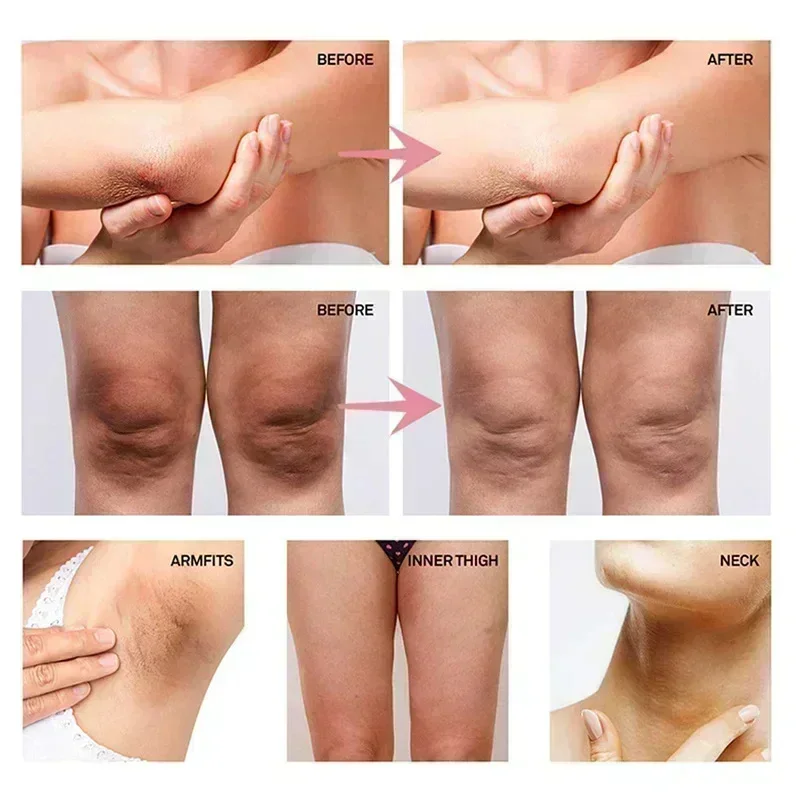 Collagen Underarm Whitening Cr - огляд і ціна Anti-Aging Face Cream