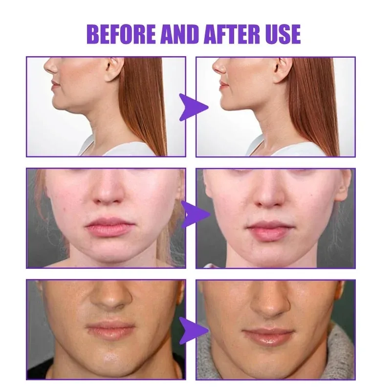 Face-lift Slimming Cream Slimm - огляд і ціна Anti-Aging Face Cream